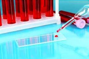 Hemuskania of blood waste for parasites