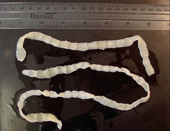 broad tapeworm from the human body