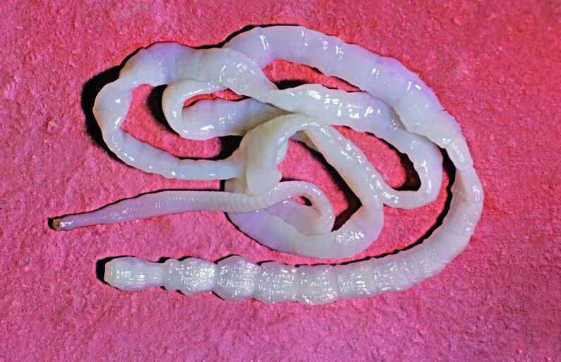 Beef tapeworm is a common intestinal worm.