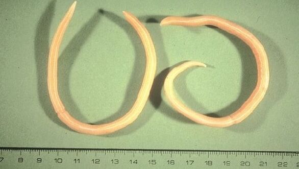 Roundworms are worms that cause fatigue and coughing.