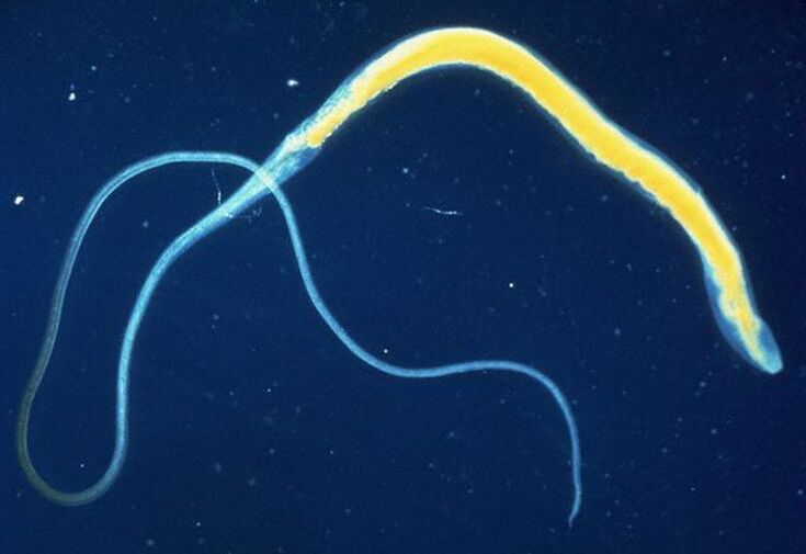 The whipworm is a common intestinal parasite.