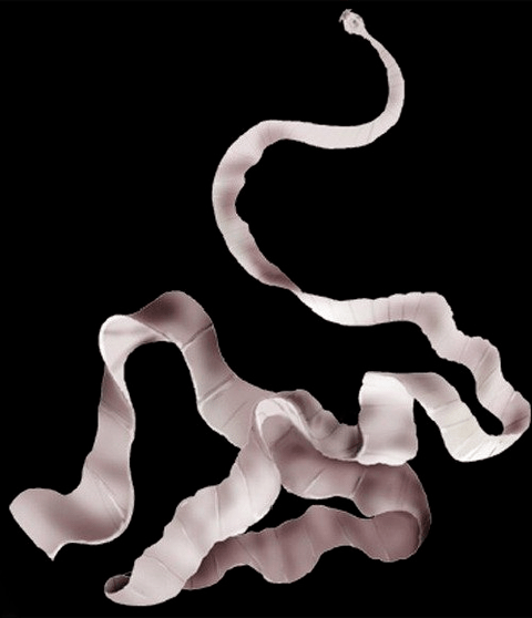 What does the pork tapeworm look like in the human body