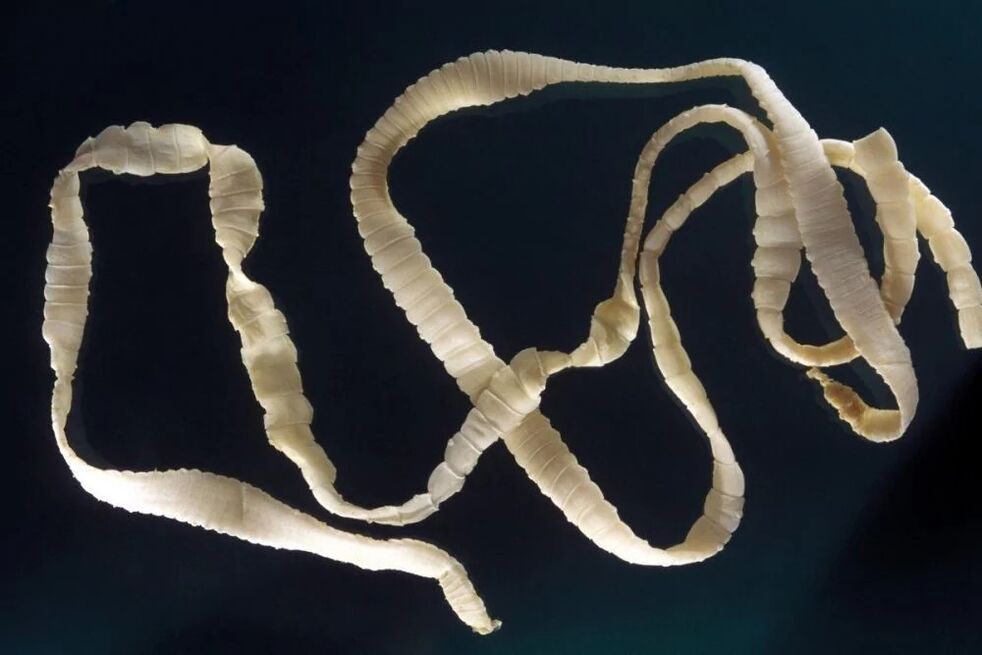 Tapeworm, a parasite of the human body